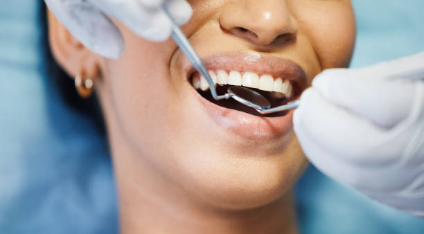 Emergency Dental Filling Replacement in MN